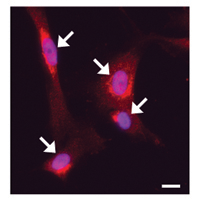 Aguilar Lab - "Use of induced pluripotent stem cells from Lowe syndrome patients provide insight into disease mechanism"